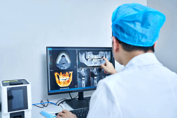 Best Emergency Wisdom Teeth Removal in Sisters, OR